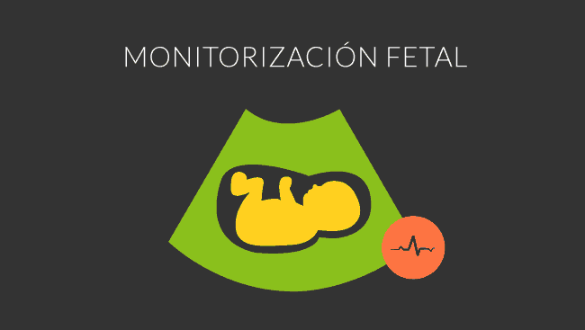 monitoreo fetal